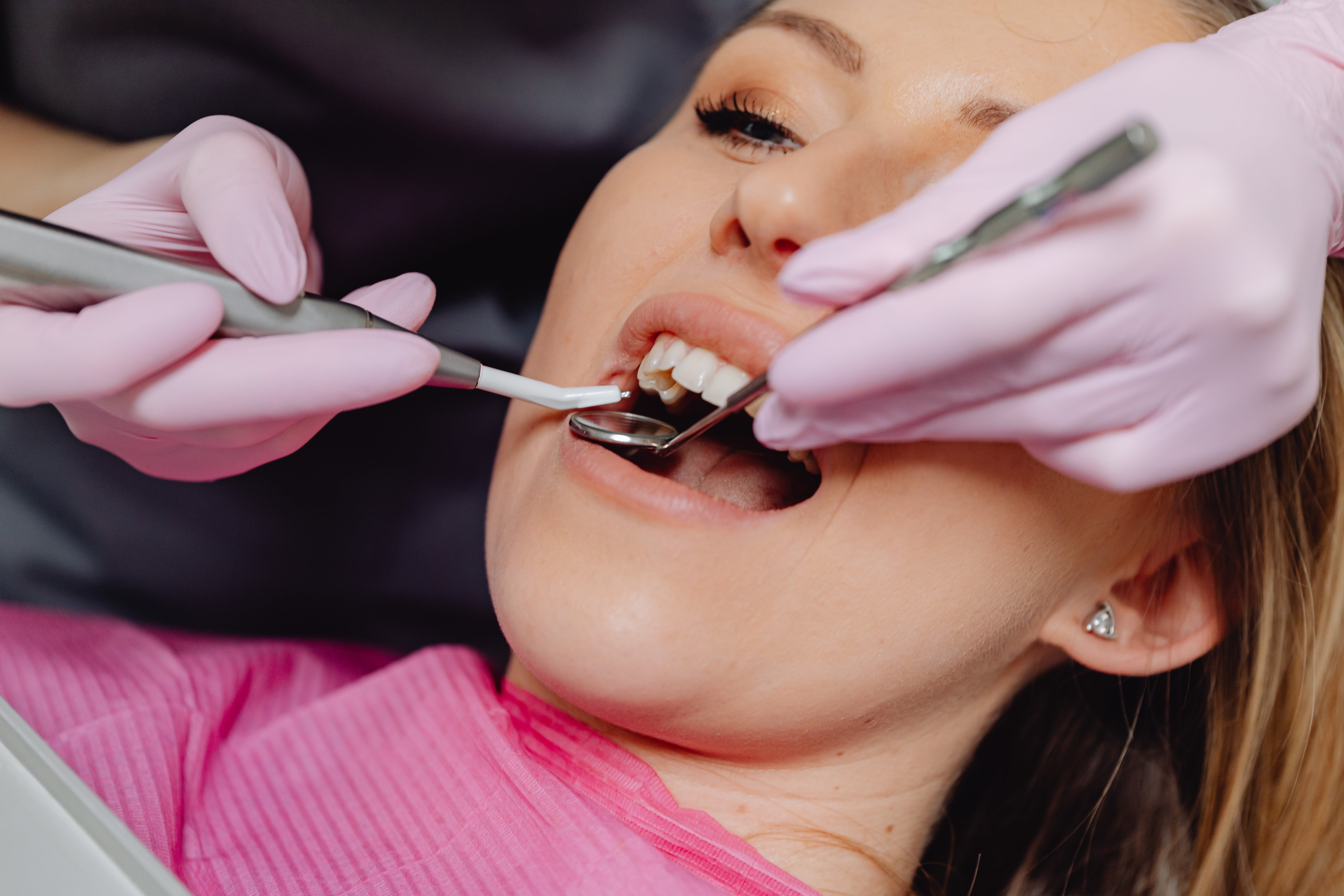 Choosing the Right Dental Implant Services in Atlanta