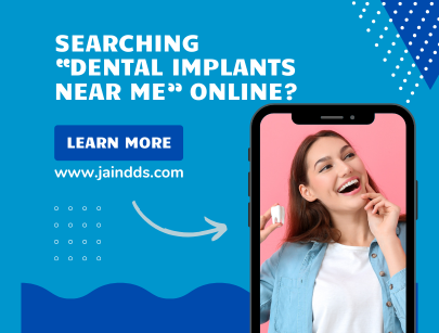 Dental implants - jain dental care