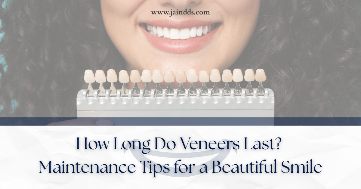 How Long Do Veneers Last? Maintenance Tips for a Beautiful Smile