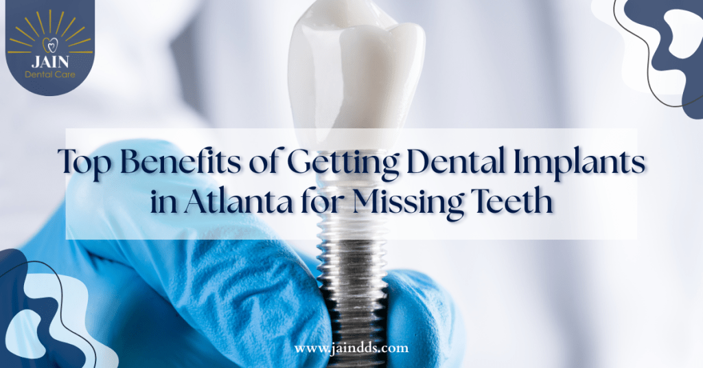 Dental implants in Atlanta