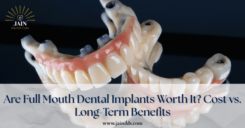 Full Dental implants
