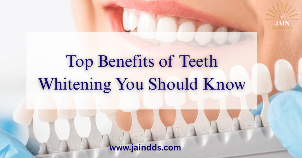 Top Benefits of Teeth Whitening You Should Know