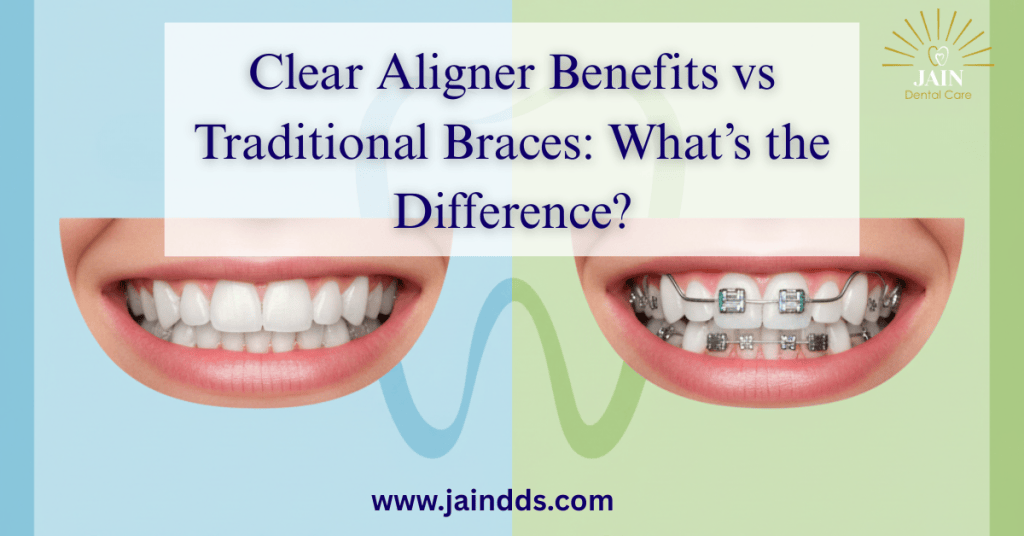 Clear Aligner Benefits vs Traditional Braces: What’s the Difference?