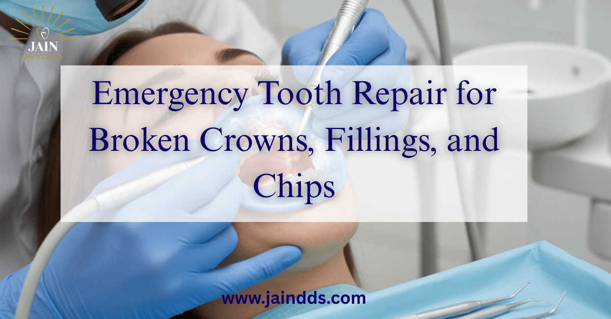 Emergency Tooth Repair for Broken Crowns, Fillings, and Chips
