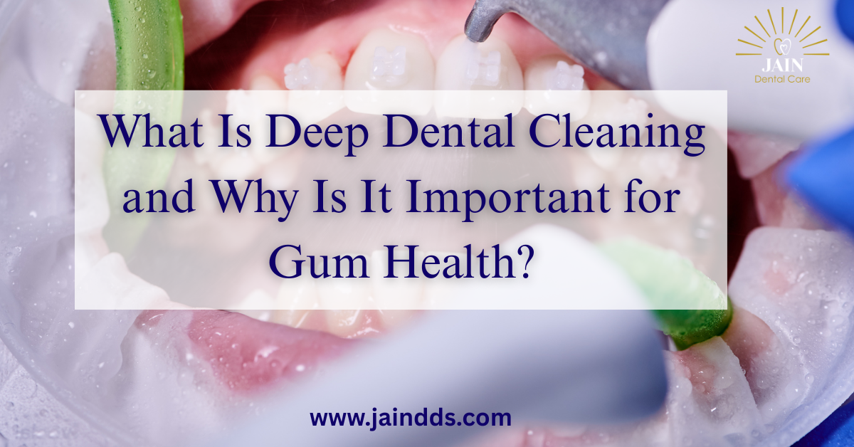 What Is Deep Dental Cleaning and Why Is It Important for Gum Health?