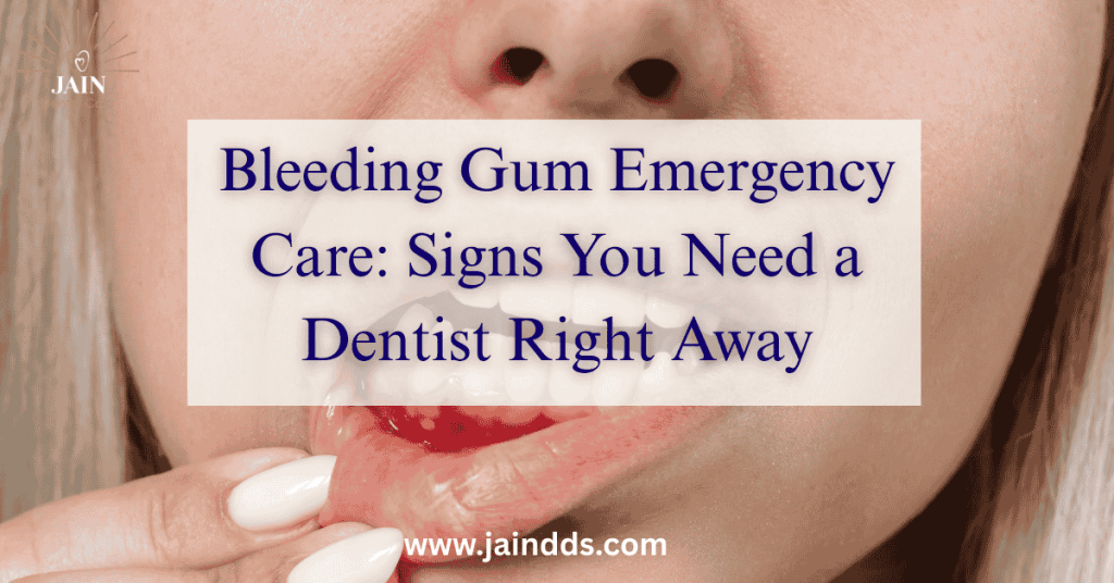 Bleeding Gum Emergency Care Signs You Need a Dentist Right Away