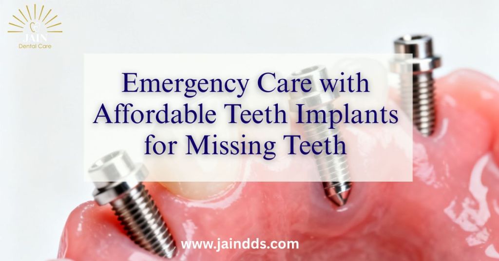 affordable teeth implants