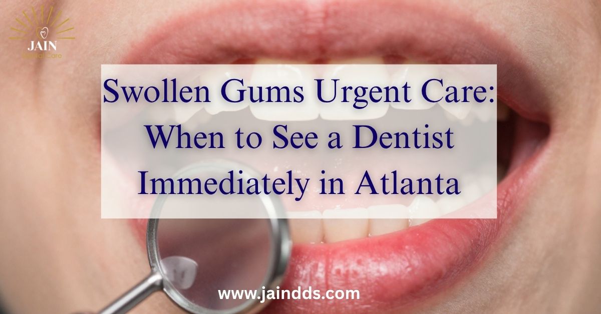 Swollen Gums Urgent Care: When to See a Dentist Immediately in Atlanta