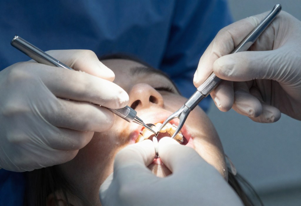 Emergency Tooth Extraction Near Me