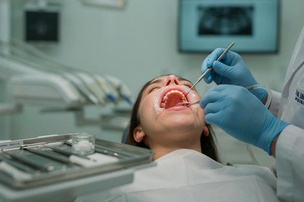 Emergency Removal of Wisdom Tooth