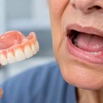 Why Do Dentures Cause Sore Spots? Common Causes and What to Do